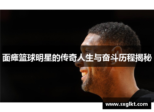 面瘫篮球明星的传奇人生与奋斗历程揭秘